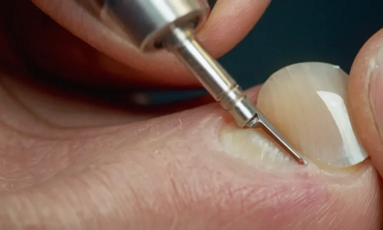 How To Fix An Ingrown Toenail: A Step-By-Step Guide